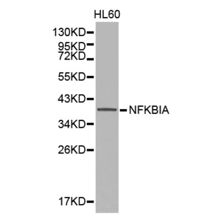 Western blot - NFKBIA Antibody from Signalway Antibody (32213) - Antibodies.com