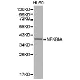 Western blot - NFKBIA Antibody from Signalway Antibody (32213) - Antibodies.com