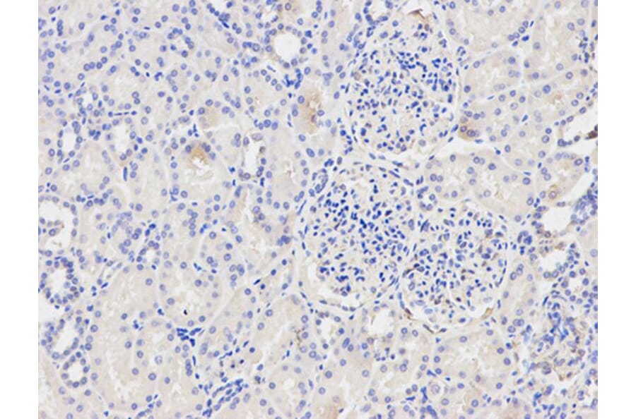 Immunohistochemistry - NFKBIA Antibody from Signalway Antibody (32213) - Antibodies.com