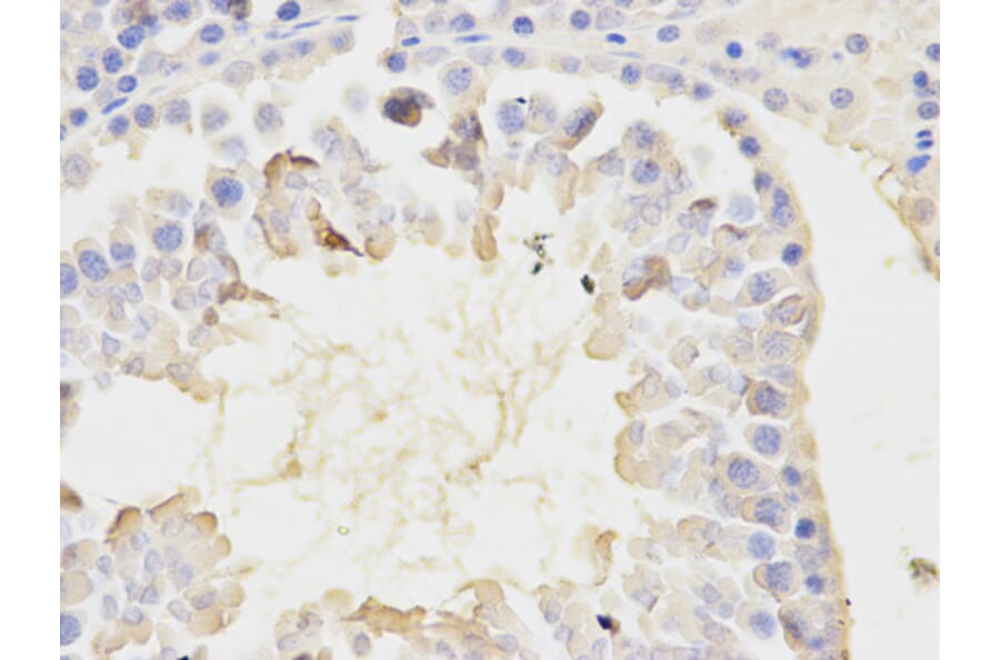 Immunohistochemistry - NFKBIA Antibody from Signalway Antibody (32213) - Antibodies.com