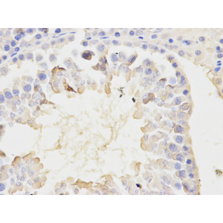 Immunohistochemistry - NFKBIA Antibody from Signalway Antibody (32213) - Antibodies.com