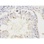 Immunohistochemistry - NFKBIA Antibody from Signalway Antibody (32213) - Antibodies.com