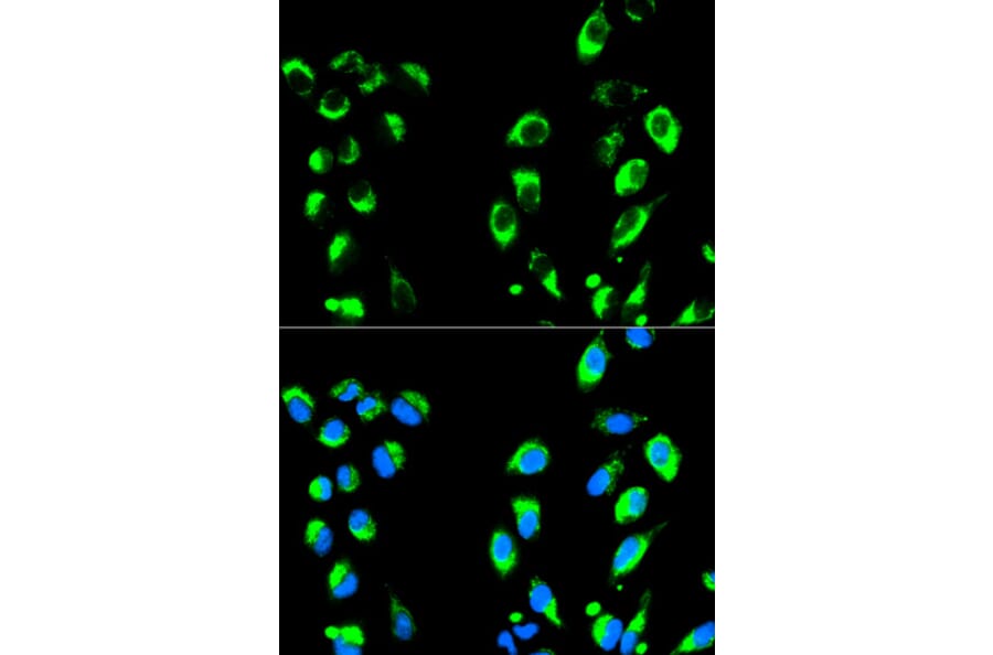 Immunofluorescence - NFKBIA Antibody from Signalway Antibody (32213) - Antibodies.com