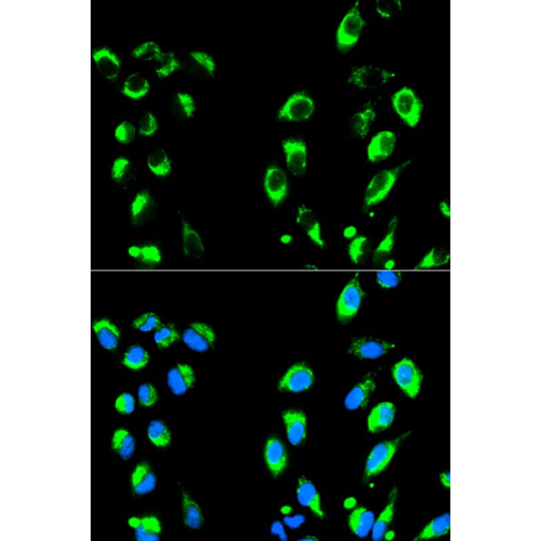 Immunofluorescence - NFKBIA Antibody from Signalway Antibody (32213) - Antibodies.com