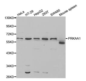 Western blot - PRKAA1 Antibody from Signalway Antibody (32244) - Antibodies.com