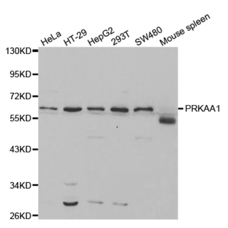 Western blot - PRKAA1 Antibody from Signalway Antibody (32244) - Antibodies.com