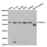 Western blot - PRKAA1 Antibody from Signalway Antibody (32244) - Antibodies.com