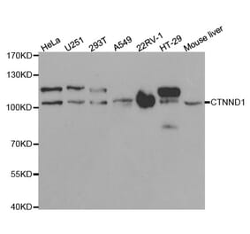 Western blot - CTNND1 Antibody from Signalway Antibody (32361) - Antibodies.com