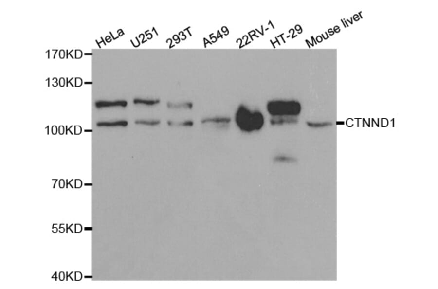 Western blot - CTNND1 Antibody from Signalway Antibody (32361) - Antibodies.com