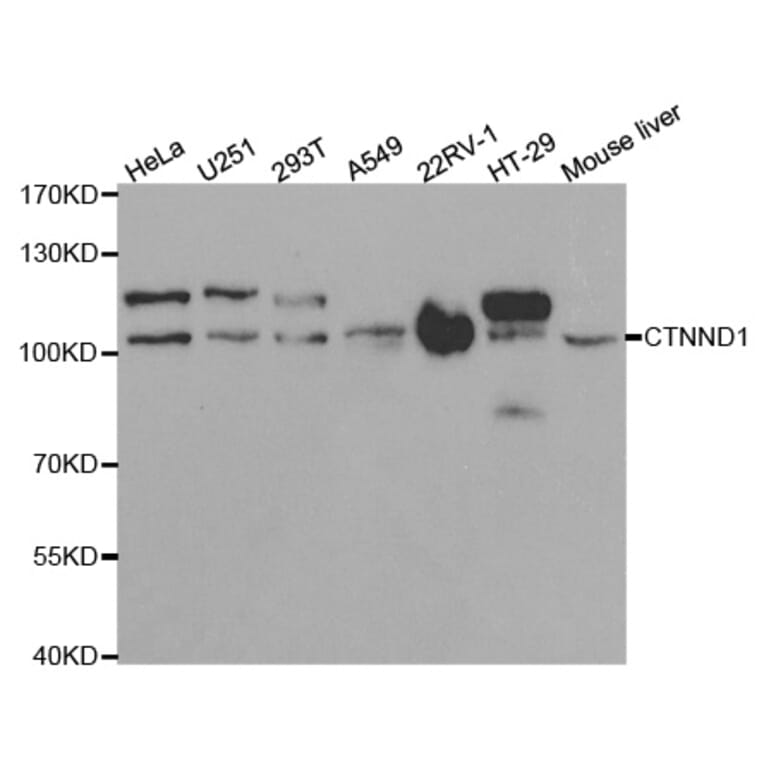 Western blot - CTNND1 Antibody from Signalway Antibody (32361) - Antibodies.com