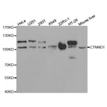 Western blot - CTNND1 Antibody from Signalway Antibody (32361) - Antibodies.com