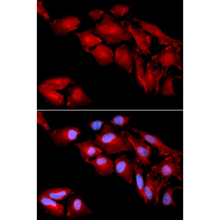 Immunofluorescence - CTNND1 Antibody from Signalway Antibody (32361) - Antibodies.com
