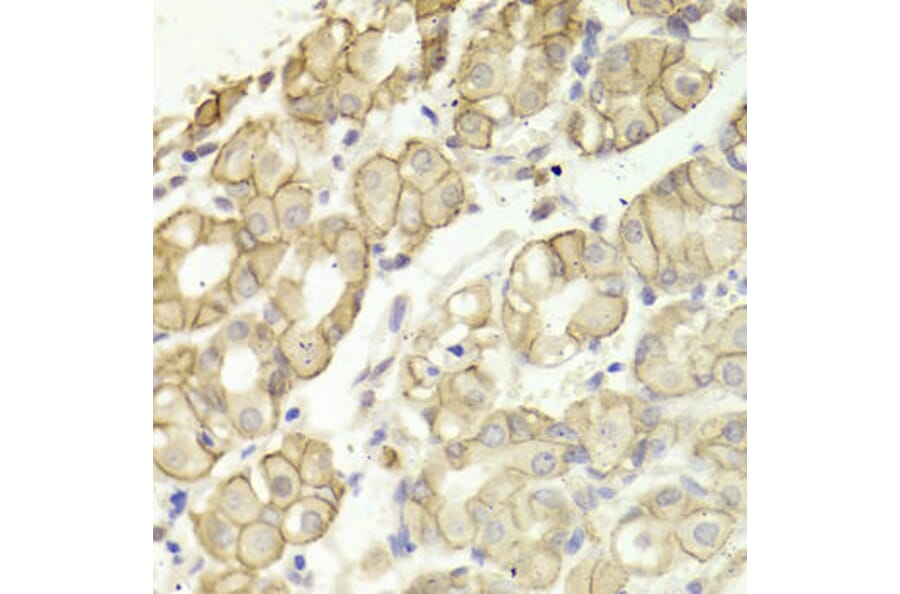 Immunohistochemistry - CTNND1 Antibody from Signalway Antibody (32361) - Antibodies.com