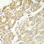 Immunohistochemistry - CTNND1 Antibody from Signalway Antibody (32361) - Antibodies.com