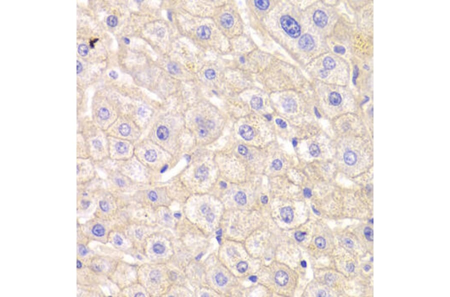 Immunohistochemistry - CTNND1 Antibody from Signalway Antibody (32361) - Antibodies.com