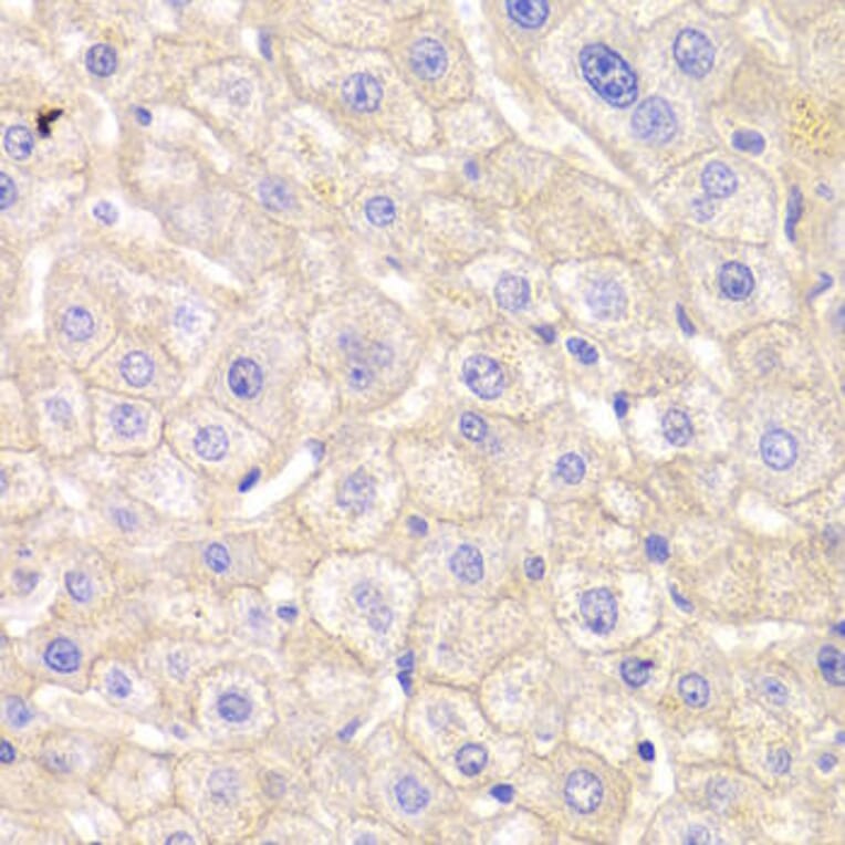 Immunohistochemistry - CTNND1 Antibody from Signalway Antibody (32361) - Antibodies.com