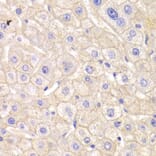 Immunohistochemistry - CTNND1 Antibody from Signalway Antibody (32361) - Antibodies.com