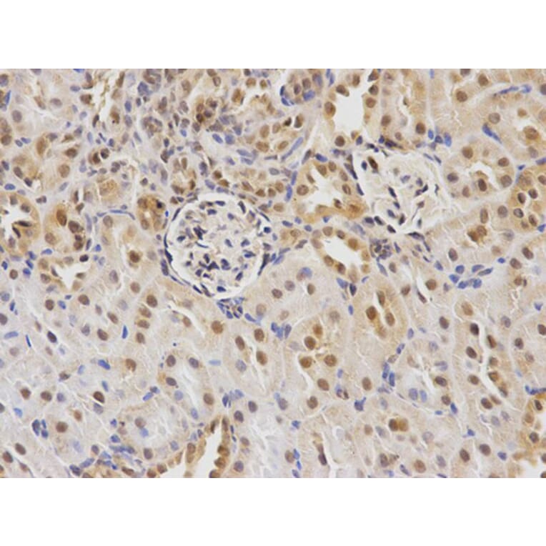 Immunohistochemistry - CDC25C Antibody from Signalway Antibody (32378) - Antibodies.com