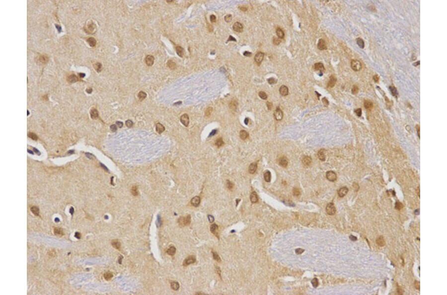 Immunohistochemistry - CDC25C Antibody from Signalway Antibody (32378) - Antibodies.com