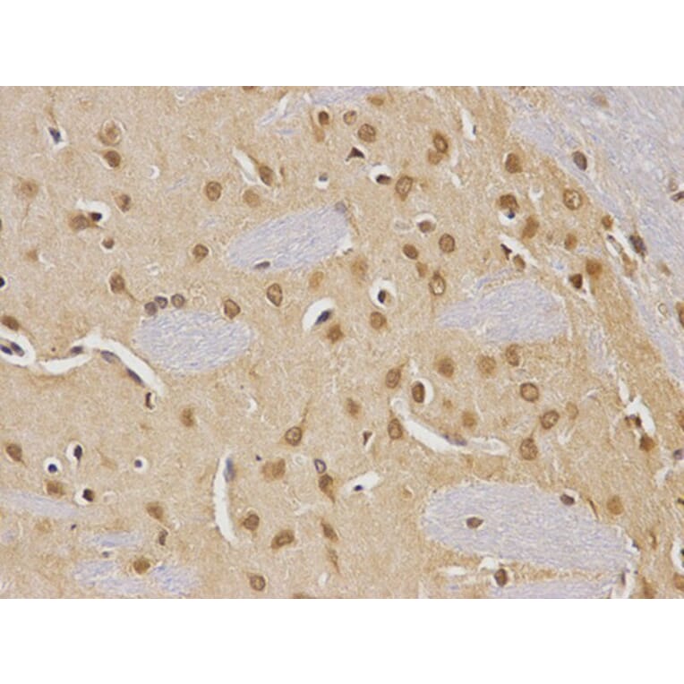 Immunohistochemistry - CDC25C Antibody from Signalway Antibody (32378) - Antibodies.com