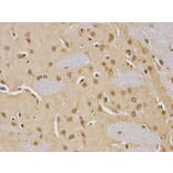 Immunohistochemistry - CDC25C Antibody from Signalway Antibody (32378) - Antibodies.com