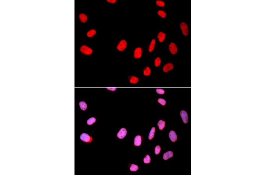 Immunofluorescence - CDC25C Antibody from Signalway Antibody (32378) - Antibodies.com