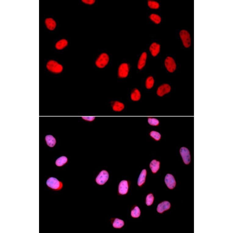 Immunofluorescence - CDC25C Antibody from Signalway Antibody (32378) - Antibodies.com