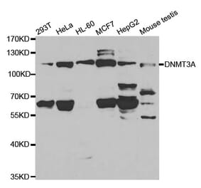 Western blot - DNMT3A Antibody from Signalway Antibody (32580) - Antibodies.com