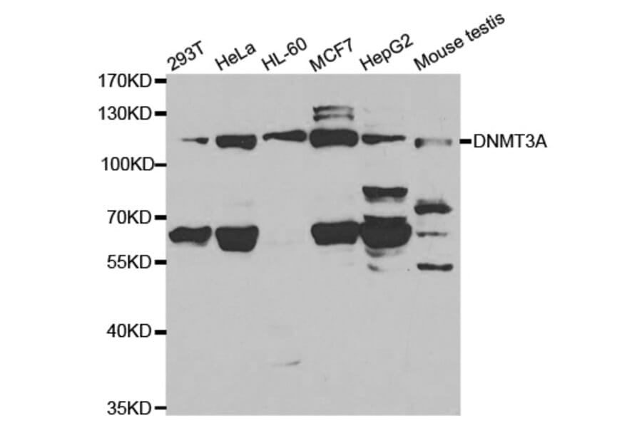Western blot - DNMT3A Antibody from Signalway Antibody (32580) - Antibodies.com