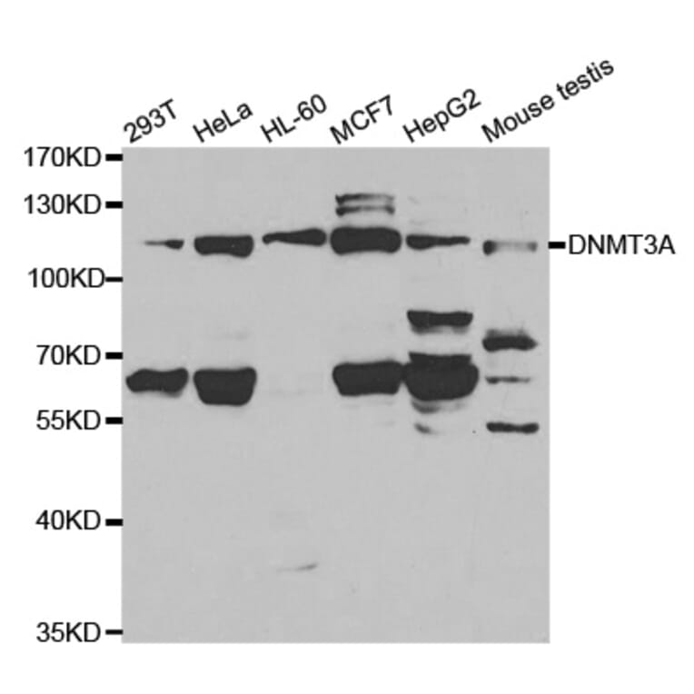 Western blot - DNMT3A Antibody from Signalway Antibody (32580) - Antibodies.com