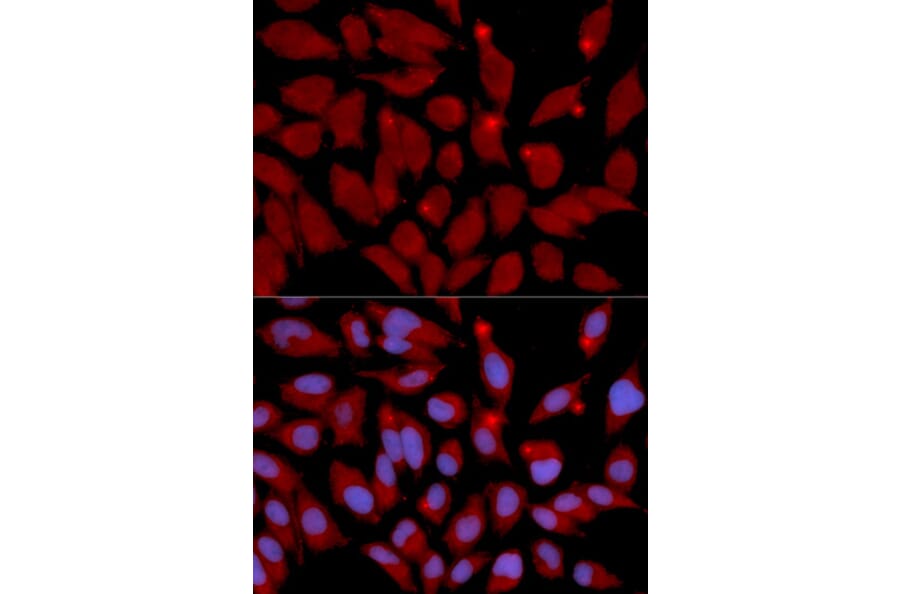 Immunofluorescence - DNMT3A Antibody from Signalway Antibody (32580) - Antibodies.com