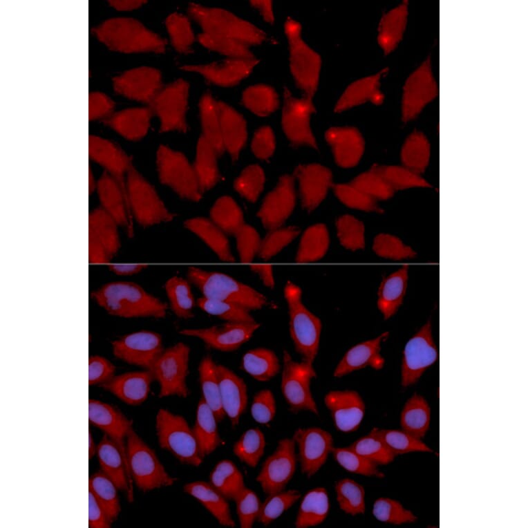 Immunofluorescence - DNMT3A Antibody from Signalway Antibody (32580) - Antibodies.com