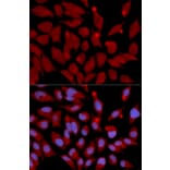 Immunofluorescence - DNMT3A Antibody from Signalway Antibody (32580) - Antibodies.com