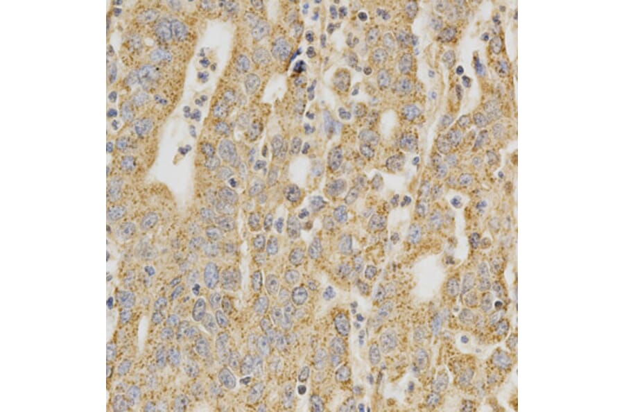 Immunohistochemistry - DNMT3A Antibody from Signalway Antibody (32580) - Antibodies.com