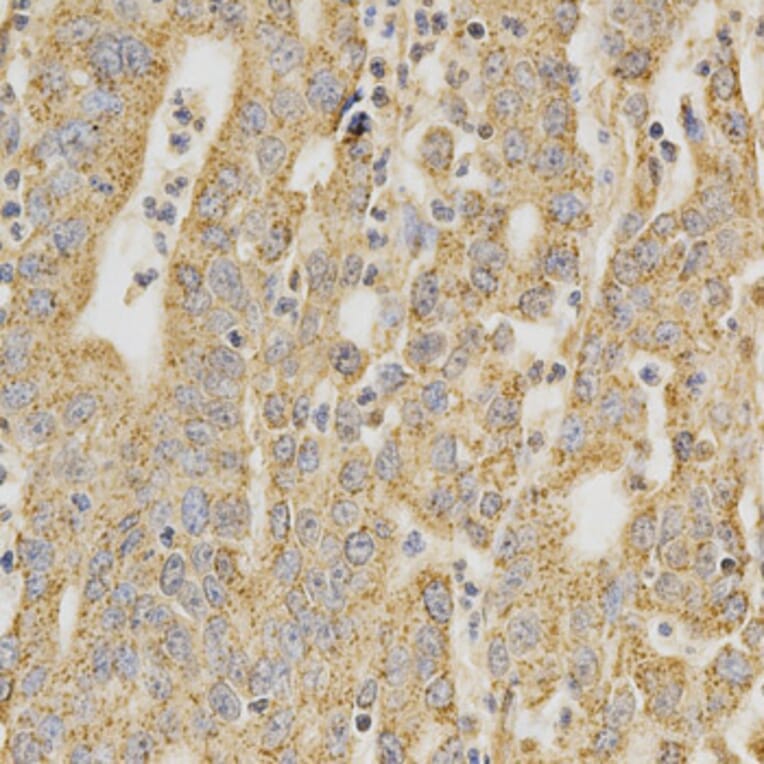 Immunohistochemistry - DNMT3A Antibody from Signalway Antibody (32580) - Antibodies.com