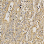 Immunohistochemistry - DNMT3A Antibody from Signalway Antibody (32580) - Antibodies.com
