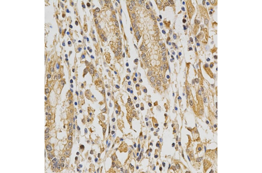 Immunohistochemistry - DNMT3A Antibody from Signalway Antibody (32580) - Antibodies.com