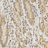 Immunohistochemistry - DNMT3A Antibody from Signalway Antibody (32580) - Antibodies.com
