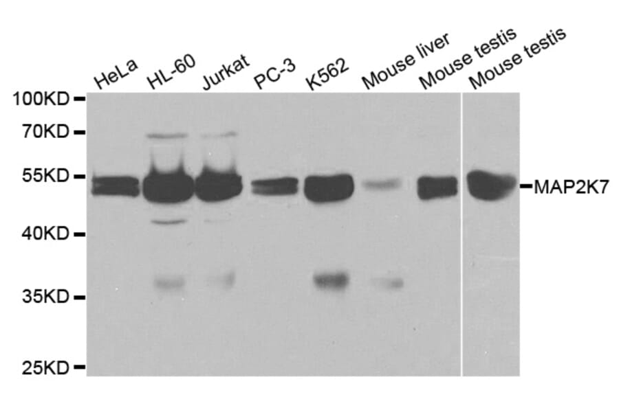 Western blot - MAP2K7 Antibody from Signalway Antibody (32651) - Antibodies.com