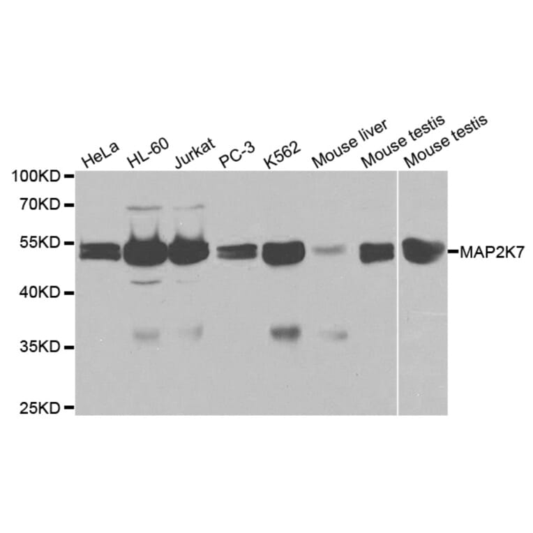 Western blot - MAP2K7 Antibody from Signalway Antibody (32651) - Antibodies.com