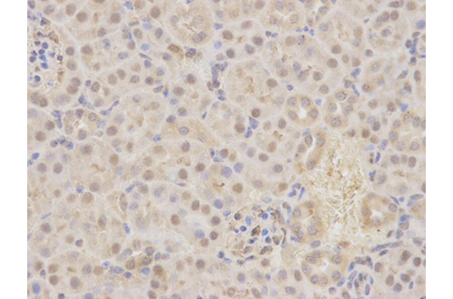 Immunohistochemistry - MAP2K7 Antibody from Signalway Antibody (32651) - Antibodies.com