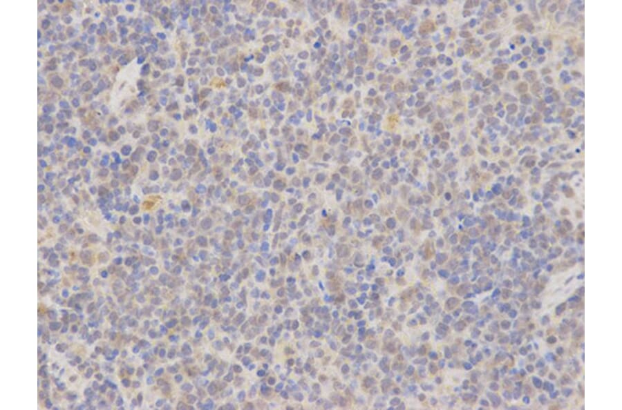 Immunohistochemistry - MAP2K7 Antibody from Signalway Antibody (32651) - Antibodies.com