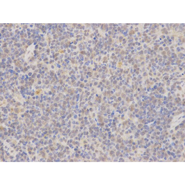 Immunohistochemistry - MAP2K7 Antibody from Signalway Antibody (32651) - Antibodies.com