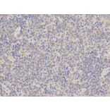 Immunohistochemistry - MAP2K7 Antibody from Signalway Antibody (32651) - Antibodies.com