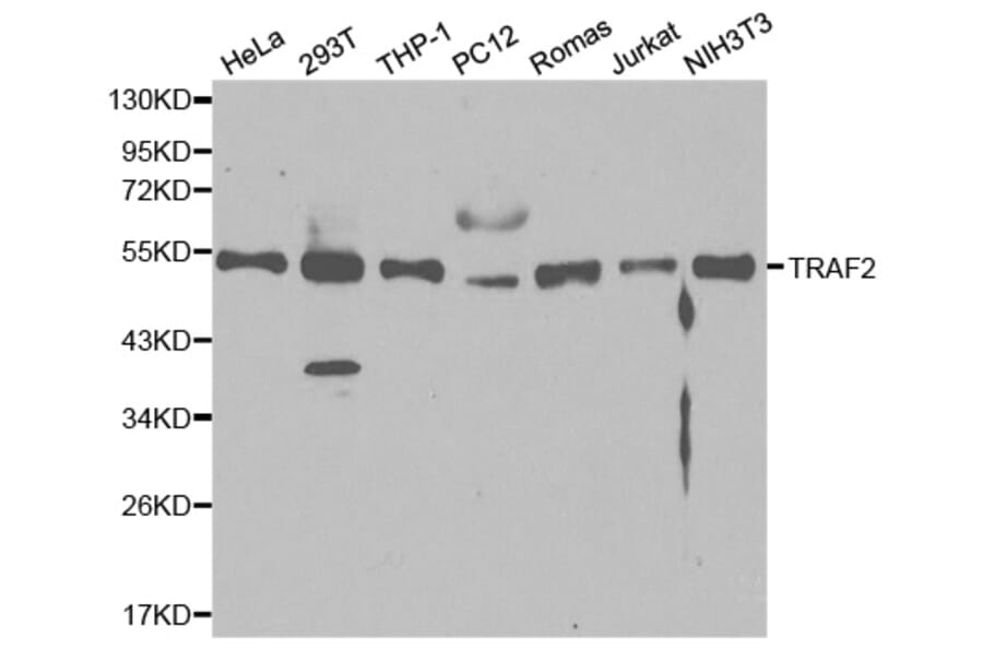 Western blot - TRAF2 Antibody from Signalway Antibody (32094) - Antibodies.com