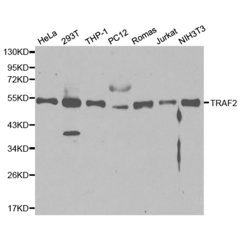 Western blot - TRAF2 Antibody from Signalway Antibody (32094) - Antibodies.com
