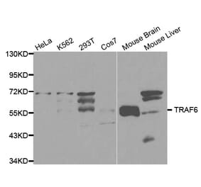 Western blot - TRAF6 Antibody from Signalway Antibody (32102) - Antibodies.com