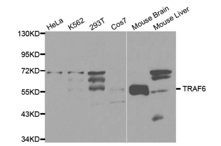 Western blot - TRAF6 Antibody from Signalway Antibody (32102) - Antibodies.com