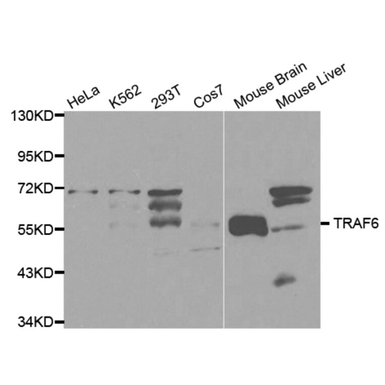 Western blot - TRAF6 Antibody from Signalway Antibody (32102) - Antibodies.com