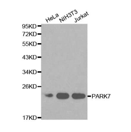 Western blot - PARK7 Antibody from Signalway Antibody (32112) - Antibodies.com